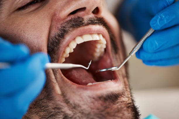 Best Weekend Emergency Dentist in Oak Trail Shores, TX