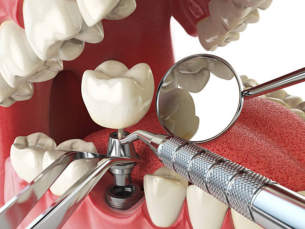 Best Emergency Tooth Extraction in Oak Trail Shores, TX