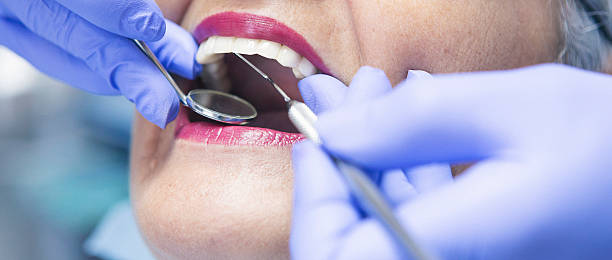 Best Emergency Tooth Extraction in Oak Trail Shores, TX